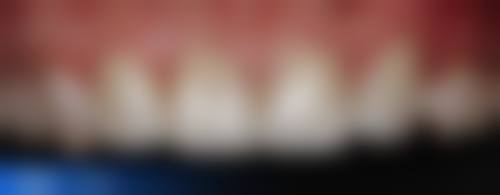 成都成华橙心口腔门诊部及成都美昂口腔门诊部宋啸宇医生的收费价格表