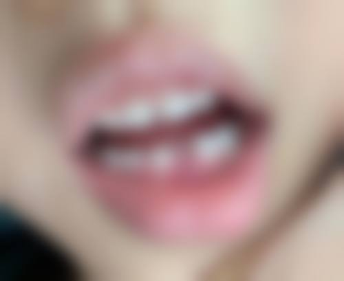 四川大学华 西第二医院夏斌医生技术特色