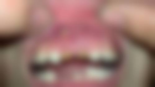 蒙钰媛医生怎么预约挂号