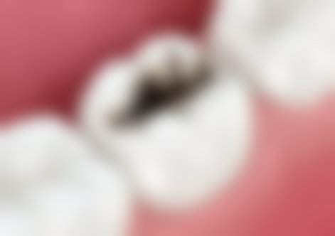 衢州郑兰琴口腔诊所医院预约方式