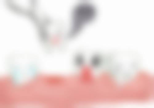 四川大学华 西医院胡倩医生技术特色