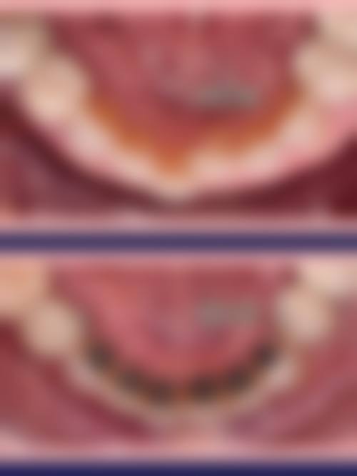 河北省保定市第二医院庞杰医生口碑评价