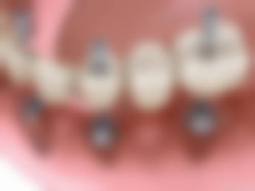 重庆齿齿美口腔医院周柏君医生技术特色