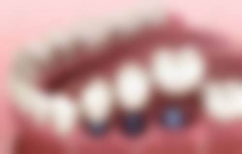 烟台胶东半岛口腔医院王福来医生的收费价格表