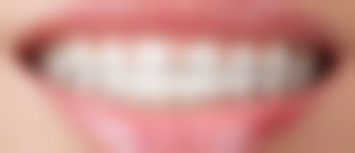 重庆渝博口腔医院项目价格