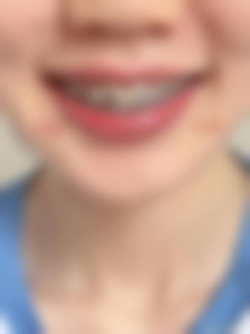 北京嘉信泽洋口腔诊所杨京粼医生技术特色