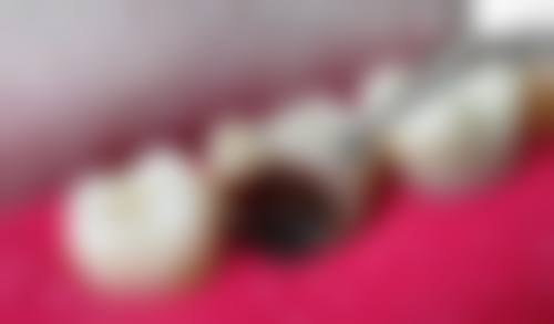 北京嘉信泽洋口腔诊所杨京粼医生的收费价格表