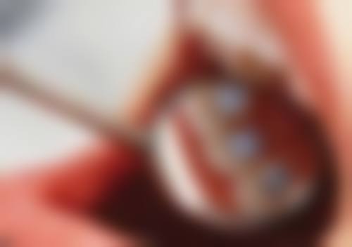 武汉大众口腔(尔雅门诊)医院顾客的口碑评价