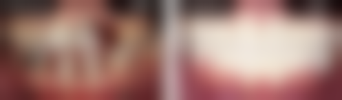 韩国来一菲牙科医院医院开展项目