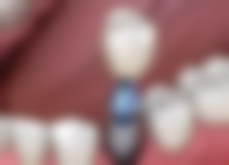 温州老年病医院口腔科医院开展项目