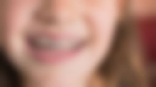 大冶华玉口腔(清和路店)医院开展项目