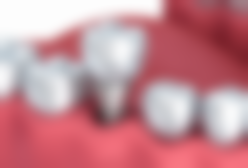 北京海德堡联合口腔诊所Luis Gallardo Lopez医生怎么预约挂号