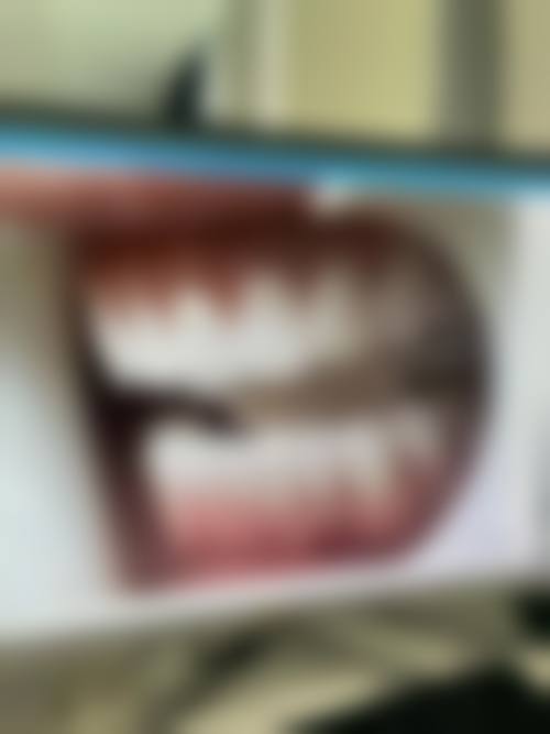 威海美辰口腔医院富宏伟医生的收费价格表