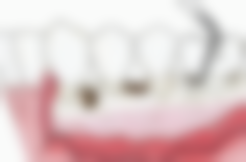 常州华釾口腔医院预约方式