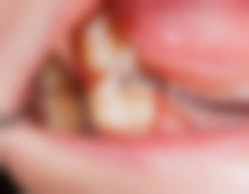 杭州口腔医院临平院区医院来院路线