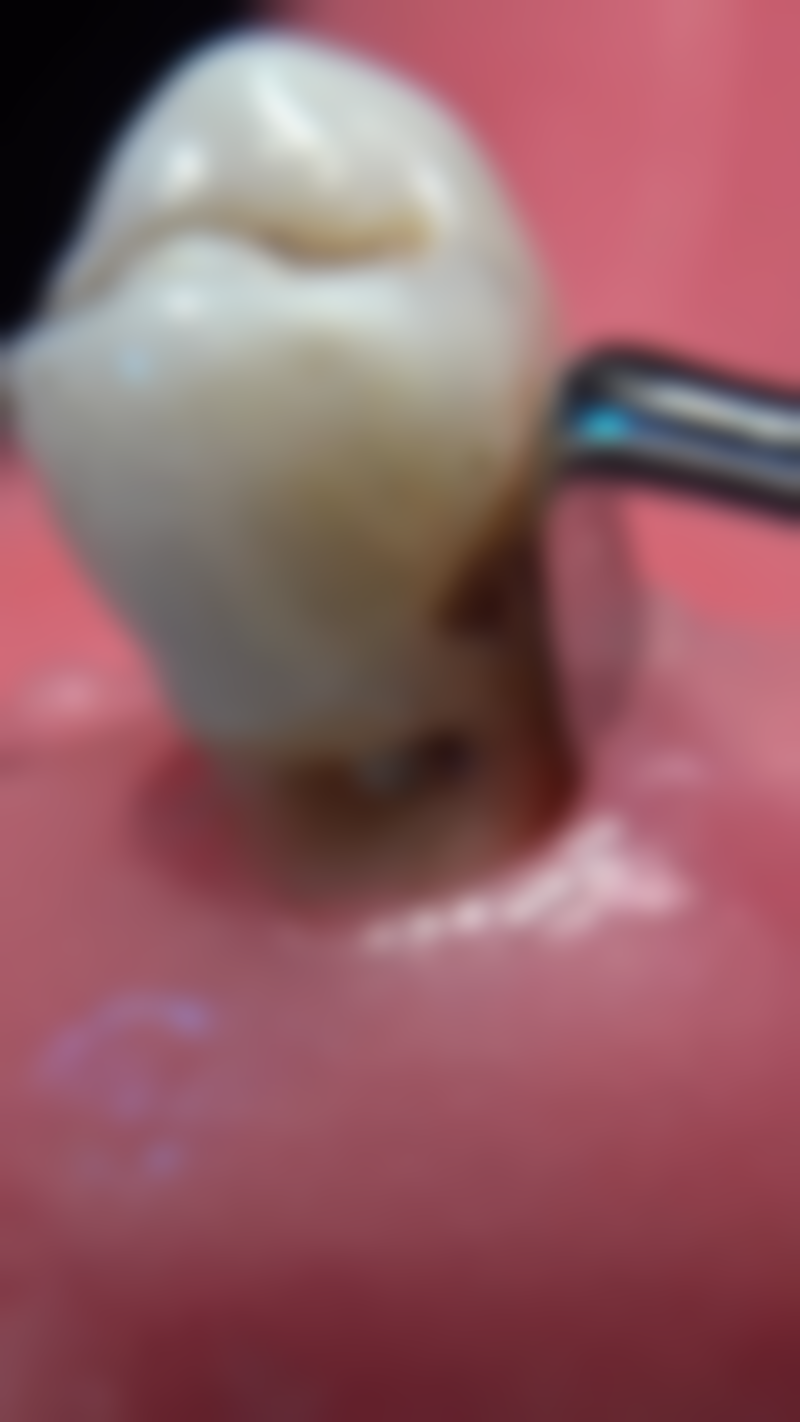 常州康贝佳口腔门诊部医院项目价格