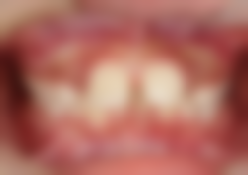 宁夏银川恩泽口腔诊所医院预约方式