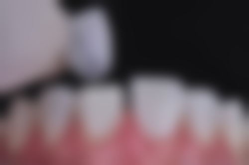 烟台伊良玖雅美口腔门诊部医院项目价格