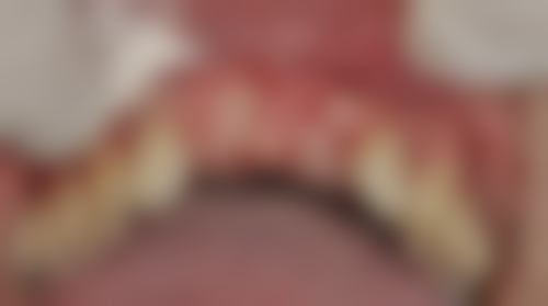 大同市第五人民医院孙利平医生怎么预约挂号