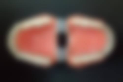 深圳微齿口腔诊所医院项目价格
