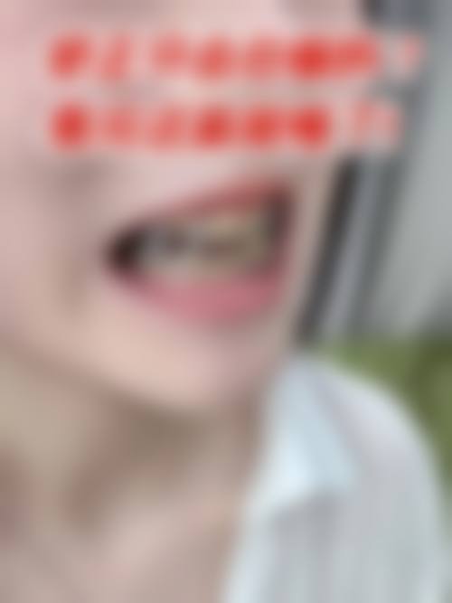 西安鼎秀齿科曹伟鸽医生擅长项目