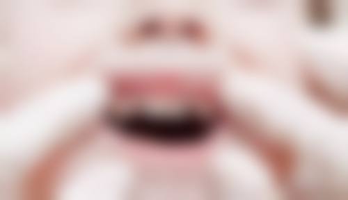 维乐中泽口腔叶燕梅医生擅长项目