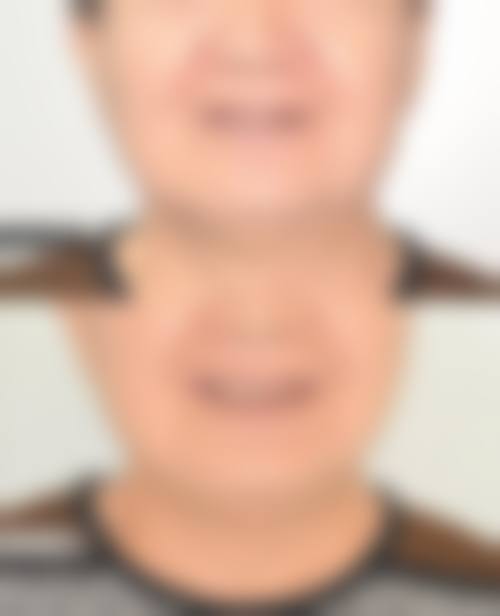 辽宁朝阳牙博士口腔门诊部王稚英医生技术特色