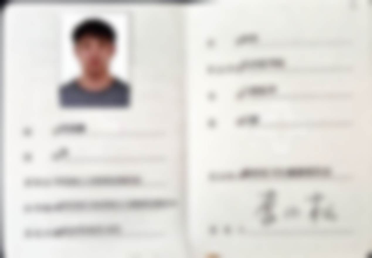 {岳阳牙歪歪口腔医院拔智齿（上颌）限首颗199元——专业高效解决智齿困扰