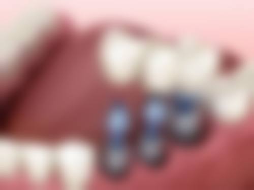 重庆医 科 大学附属口腔医院悲仲秋医生怎么预约挂号