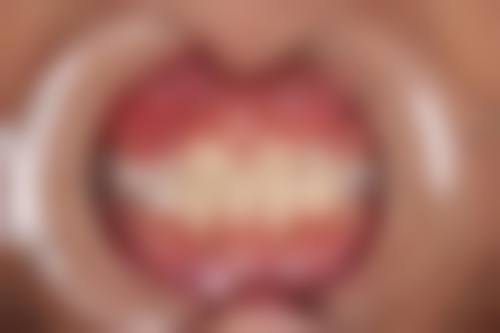 厦门拜博口腔张忠医生怎么预约挂号