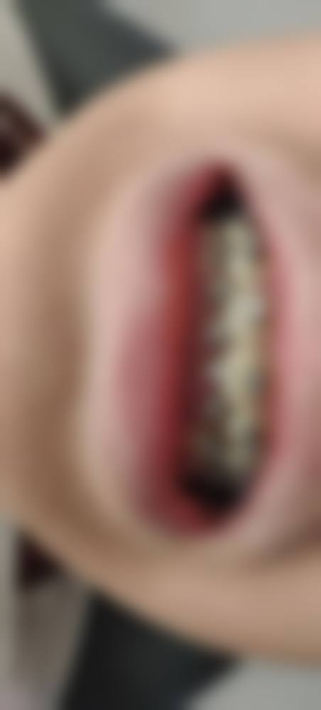 厦门拜博口腔张忠医生技术特色