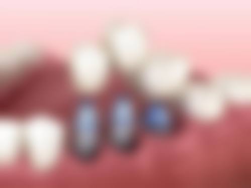 四川大学华 西天府医院王伟医生口碑评价