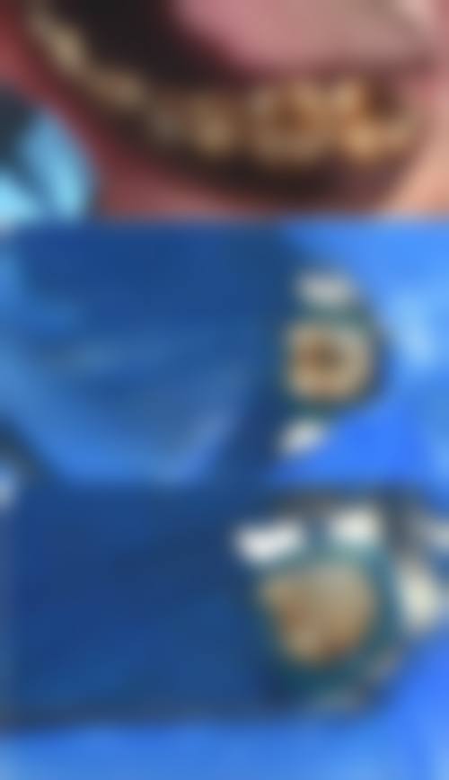 恒瑞牙病防治所王新吾医生擅长项目