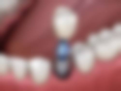 辽宁朝阳牙博士口腔门诊部王稚英医生擅长项目