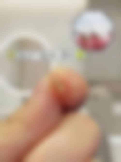 北京美年口腔医院邹立刚医生擅长项目