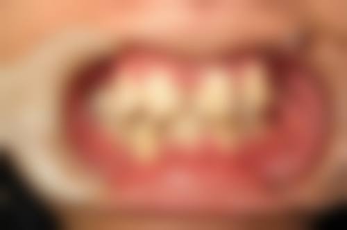 季红惠医生技术特色
