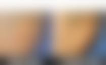 特色项目与医生：赵士红医生领衔，专注损容性皮肤修复