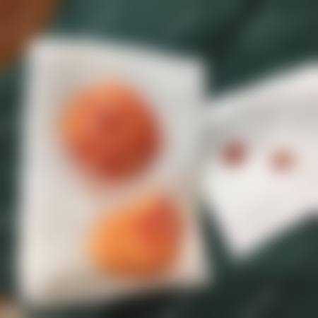 临床实例分享