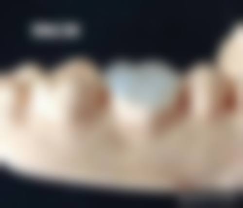 优惠活动与到院指引