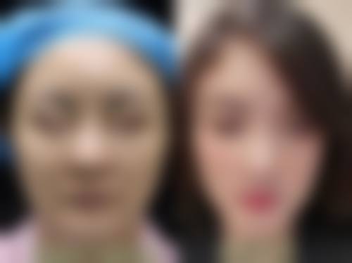 优惠活动详情：限时补贴，轻松变得更美