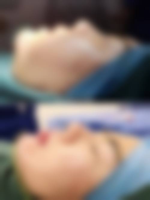优惠活动详情
