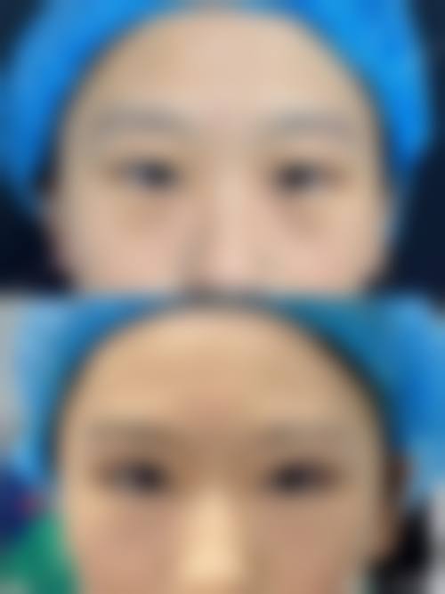 擅长项目详解