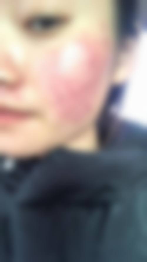限时优惠活动：高性价比实现美丽升级