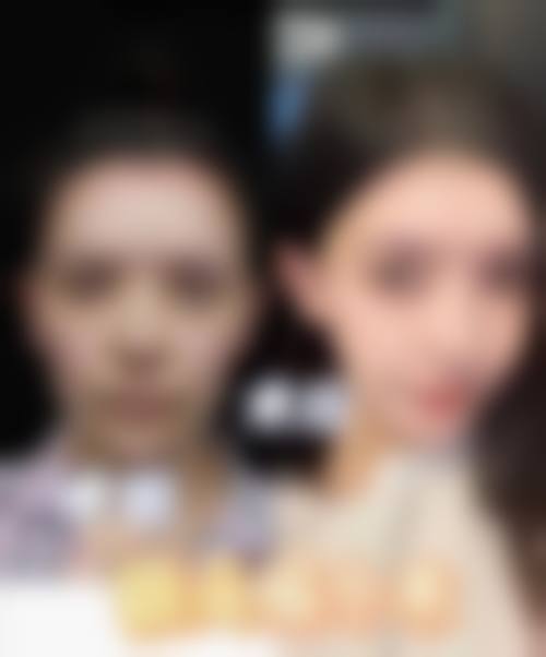 优惠活动详情:性价比突出的治疗选择