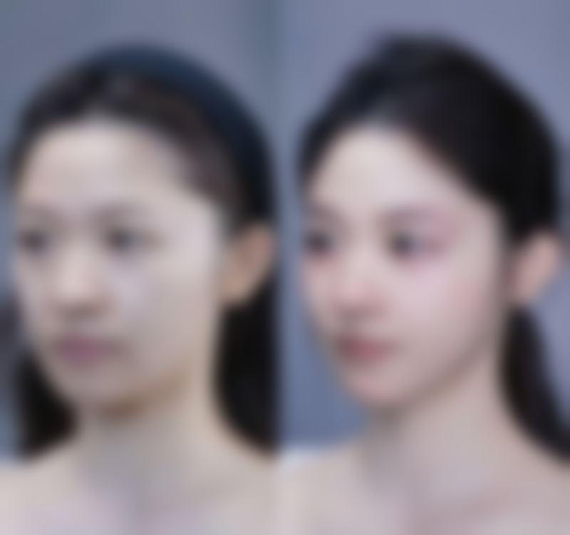 优惠活动详情:性价比之选,限时预约