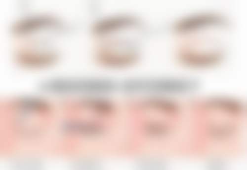 FAQ:常见问题解答,消除您的顾虑