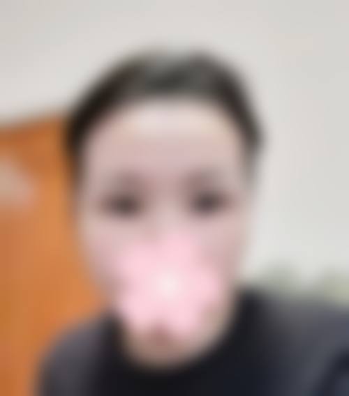 限时优惠活动——品质医美触手可及