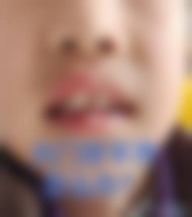 北仑现代口腔廖敏群医生怎么预约挂号