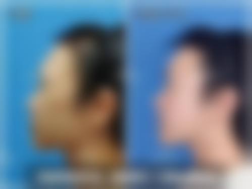 擅长项目详解