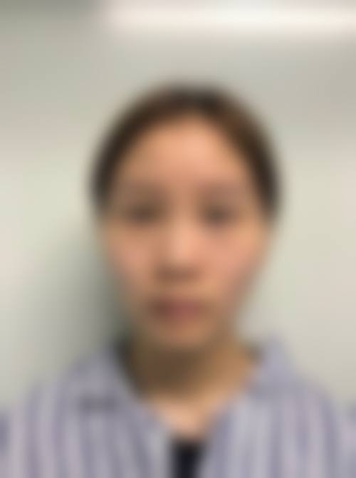 临床实例分享